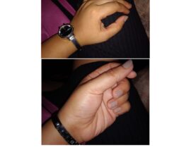 How To Get Soft Hands: 9 Effective remedies