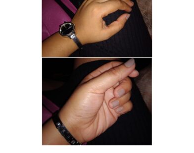 How To Get Soft Hands: 9 Effective remedies