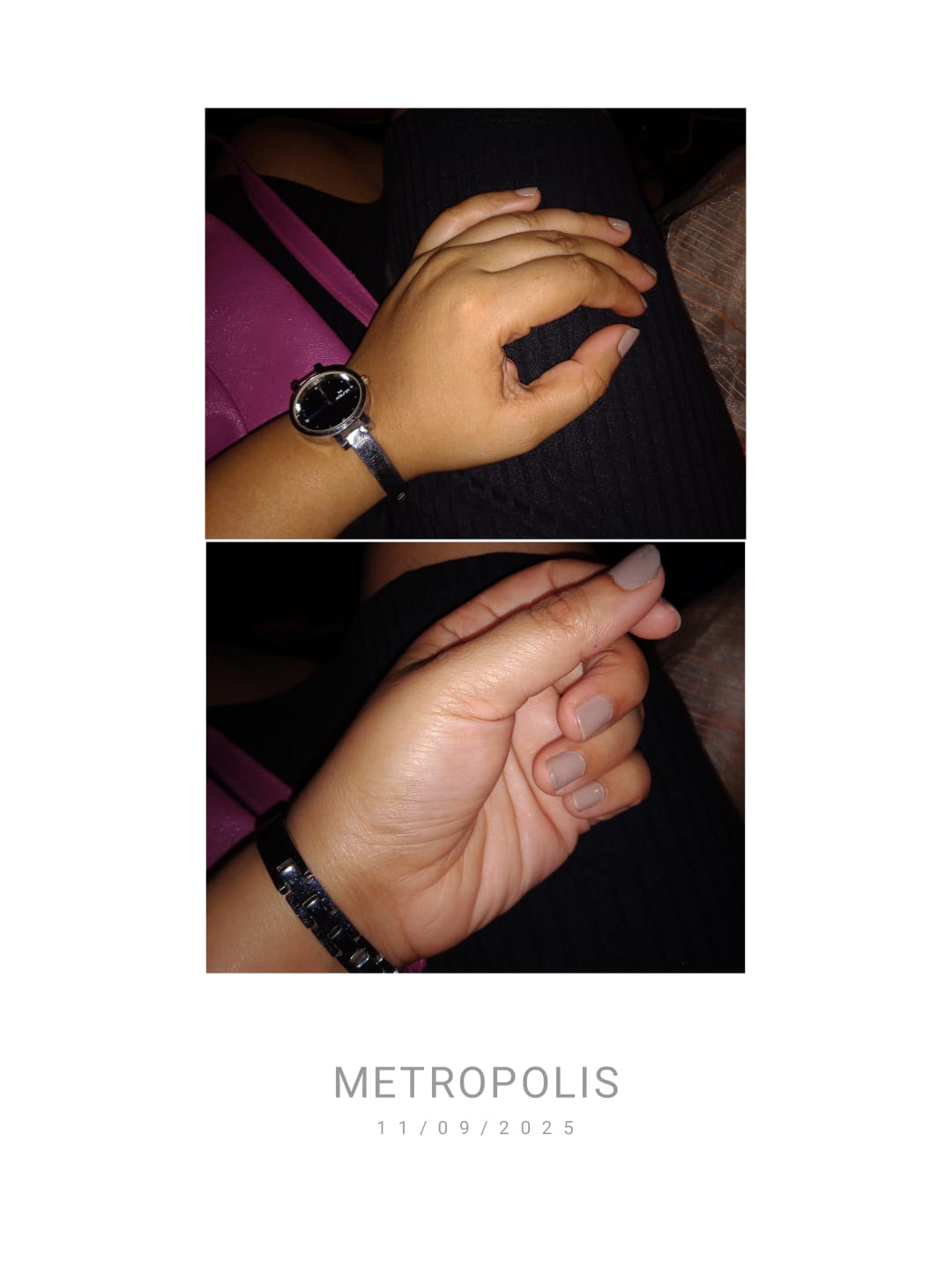 How To Get Soft Hands: 9 Effective remedies